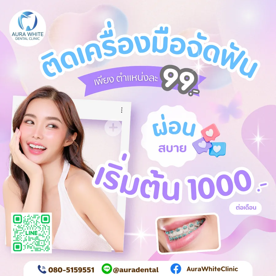 ติดเครื่องมือจัดฟัน ตำแหน่งละ 99 บาท ผ่อนสบายเริ่มต้น 1,000 บาทต่อเดือน คลินิกทันตกรรม AuraWhite