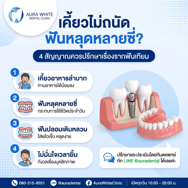 4 สัญญาณควรปรึกษารากฟันเทียม เคี้ยวไม่ถนัด ฟันหลุดหลายซี่ คลินิกบางพลี