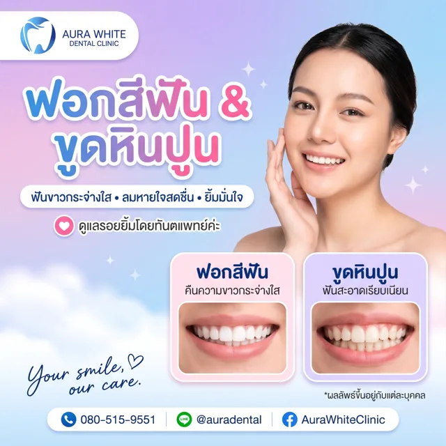 ฟอกสีฟันและขูดหินปูน โดยทันตแพทย์ คลินิกทันตกรรม AuraWhite บางพลี