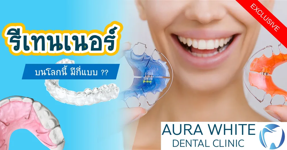 แบนเนอร์ให้ความรู้เรื่องรีเทนเนอร์ 4 ชนิด ทั้งแบบใส ลวด และพลาสติกสี คลินิกทันตกรรม AuraWhite บางพลี